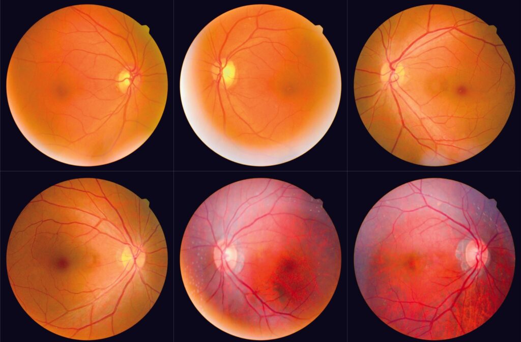 A view of retinal imaging results from a comprehensive eye exam.
